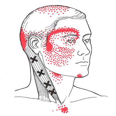 trigger point therapy in Apache Junction & Globe, AZ