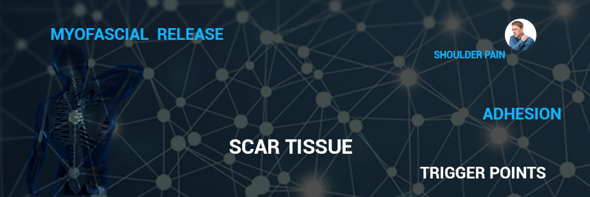 lower back pain relief with myofascial release in Mesa & Apache Junction,AZ