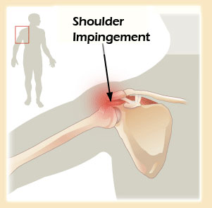 Massage shoulder pain relief in Mesa & Apache Junction, AZ